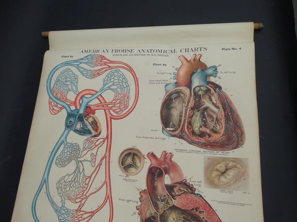 Amer-Frohse Vintage Anatomical Chart, 1918